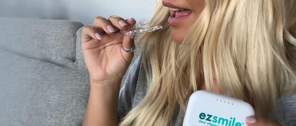 Clear Aligners