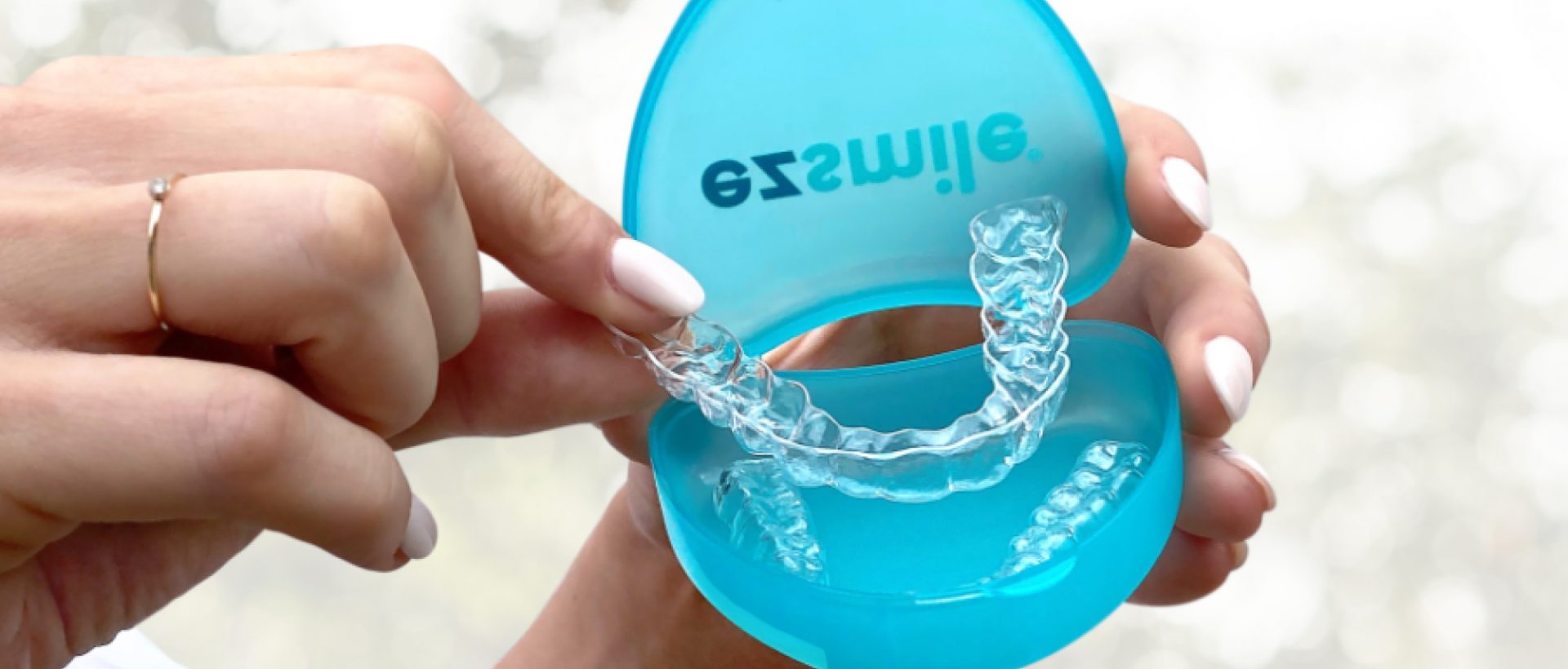 best alternatives to braces cover image by Ez Smile