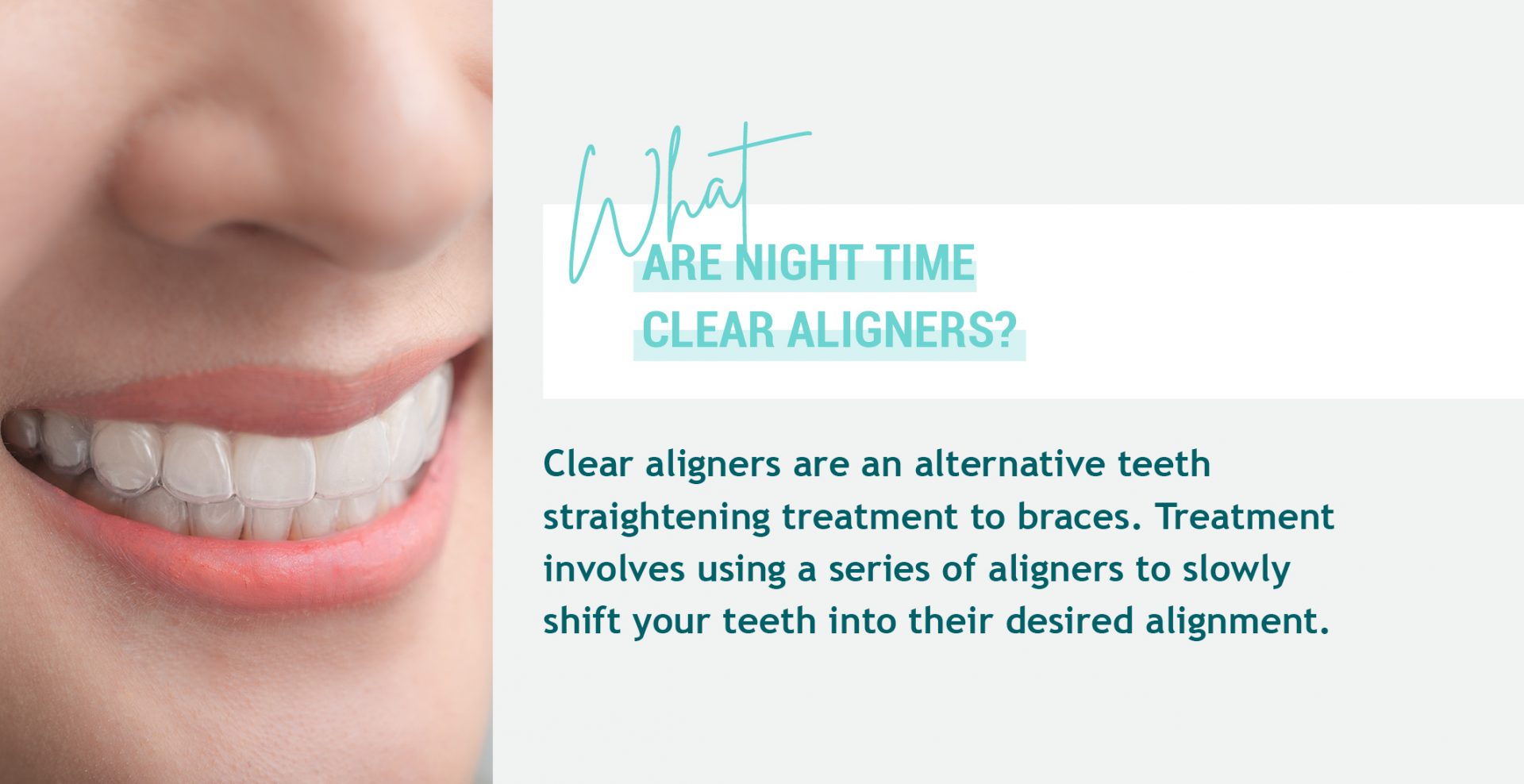 Are Nighttime Clear Aligners Necessary? Learn More EZ SMILE
