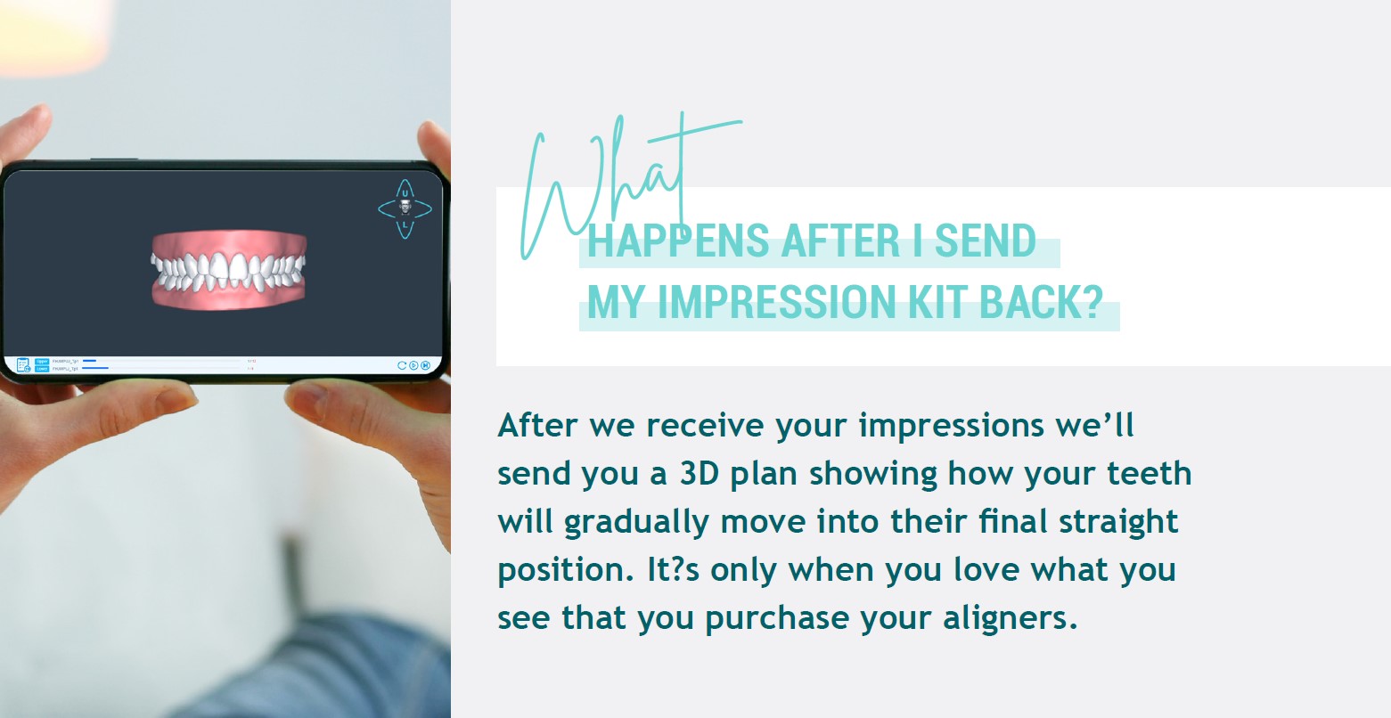 Making Teeth Impressions A StepbyStep Guide EZ SMILE