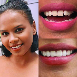 EZ SMILE Results