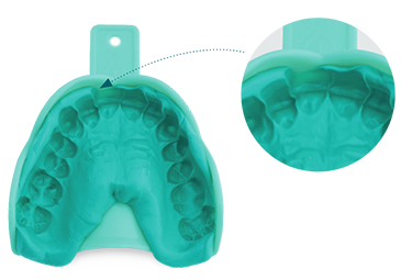 Broken teeth